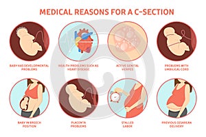 Medical reasons for cesarean delivery or c-section.