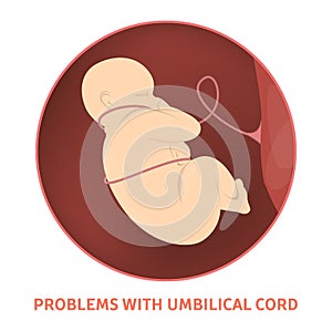 Medical reasons for cesarean delivery or c-section