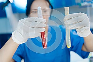 Medical samples being in hands of a lab worker