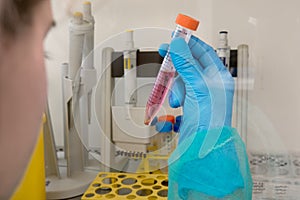 Medical samples prepared in the laboratory for cancer screening photo