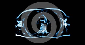 Medical scan showing human body part while scanning