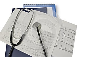 Medical stethoscope on cardiogram readings