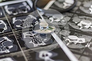 Medical stethoscope on CT scan. Medical concept