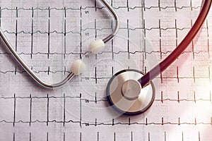 Medical stethoscope and ecg results as a graph. Heart condition in graphics