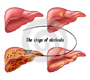 Medical structure of the liver