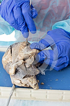 Medical student studying a sheep heart