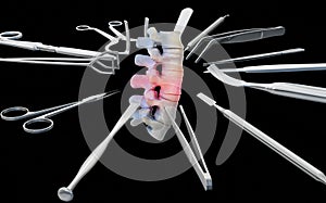 Medical surgical instruments around the part of the diseased spine. 3D illustration.