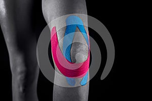 Medical taping for knee stabilization.