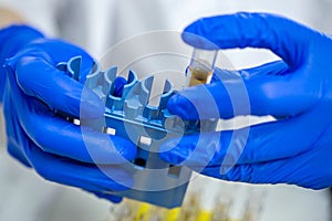 medical test tube in hand in blue gloves