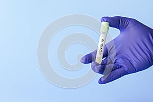 Coronavirus lab testing concept test tube in hand