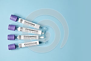 Medical test tubes with a test for coronavirus on blue background. Tests to determine the covid-19 virus.