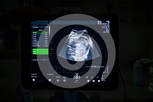 Medical ultrasound machine with a 4D image in a Labor and delivery room at a hospital