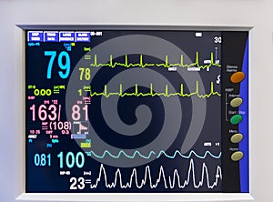 Medical vital sign monitor screen in operating room or hospital.Heart rate or blood pressure was recorded.