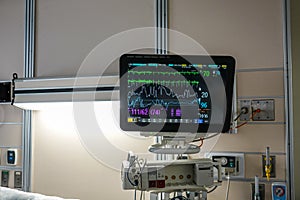 Medical vital signs monitor screen and equipment in a Hospital room.