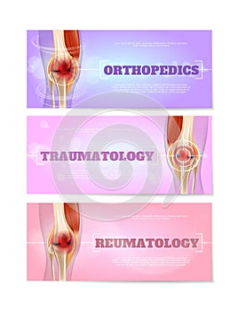 Medical Web Banners with Knee Joints Vector Set