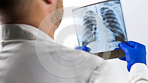 A medical worker conducts an X-ray of a person`s lungs,the doctor diagnoses and examines the picture of the lungs,pneumonia,edema.