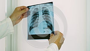 A medical worker in a hospital examines and examines an X-ray of the lungs and diagnoses a patient,pneumonia of the lungs,close-up