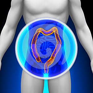 Medical X-Ray Scan - Colon