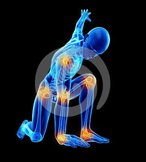 A guy with painful joints