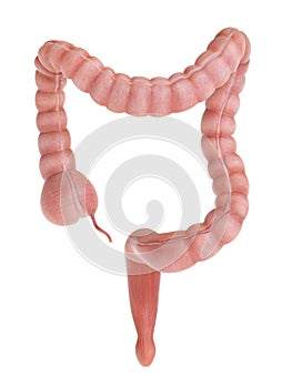 A human colon