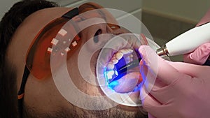 Medicine, dentistry and healthcare concept. Close-up partial view of dentist using dental curing UV lamp