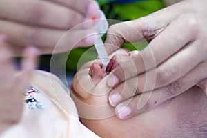 Medicine drops oral vaccination to infant photo