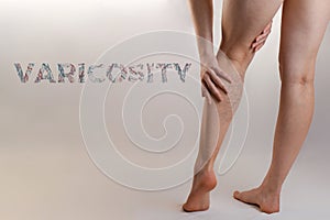 Medicine and health. The concept of female varicose veins. A woman rubs her tired legs with vascular stars. Text VARICOSITY. Copy