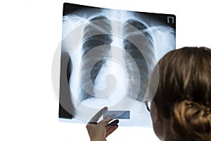 Medicine and Healthcare. Professional Radiologist Doctor Checking Patient Xray Film On Screen Against White