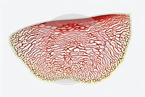 medicine Respiratory prismatic ciliated pseudostratified epithelium. The apical border of the epithelium has a layer of cilia