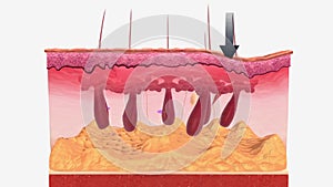 Meissner corpuscles consist of a cutaneous nerve ending responsible for transmitting the sensations of fine,