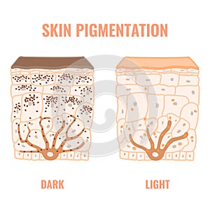 Human skin tone pigmentation diversity infographic diagram photo