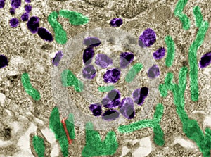 Melanin granules in skin cell. False colour TEM photo