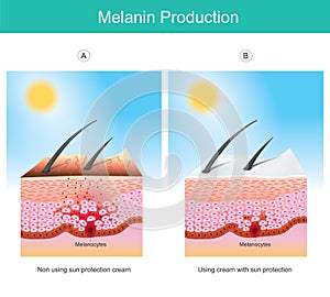 Melanin Production. Illustration showing colour human skin affect from UV rays the cause photo