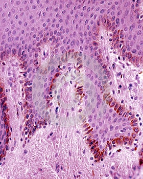 Melanocytes. Epidermis photo