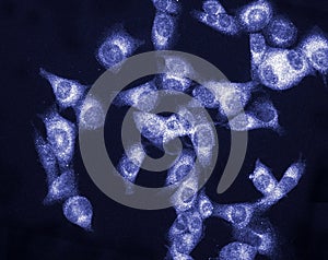 Melanoma Cancer Cell photo