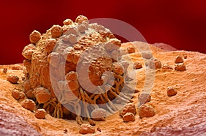 Melanoma cell a type of skin cancer closeup view 3d illustration