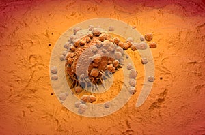 Melanoma cell a type of skin cancer isometric view 3d illustration