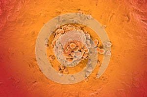 Melanoma cell a type of skin cancer top view 3d illustration