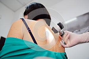 Melanoma diagnoinspectionsis. the doctor examines the patient`s mole