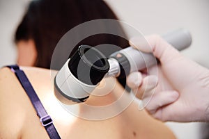 Melanoma diagnoinspectionsis. the doctor examines the patient`s mole