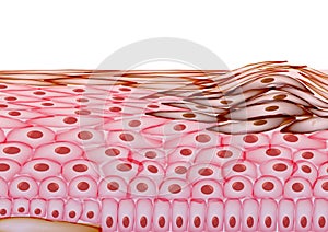 Melanoma in Layers of the Human skin, Cancer - Vector Illustration