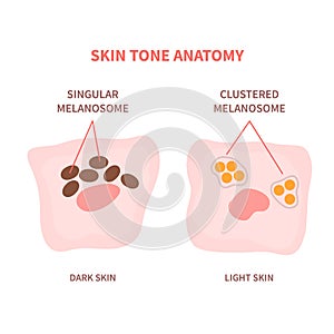 Melanosome distribution pattern in dark and light skin photo