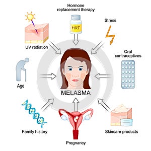 Melasma triggers. Chloasma. Skin hyperpigmentation