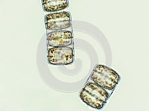 Melosira sp. algae under microscopic view