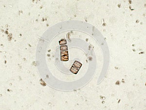 Melosira sp. algae under microscopic view