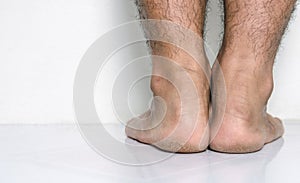 Men a feet skin cracked heels