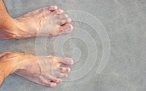 Men's feet on the beach.