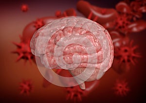 Meningitis is an inflammation of the meninges, which are the membranes that surround the brain