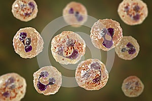 Meningococcal meningitis, cerebrospinal fluid smear photo