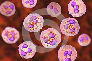 Meningococcal meningitis, cerebrospinal fluid smear photo